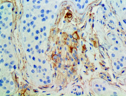 IHC of CD105 on an FFPE Testis Tissue